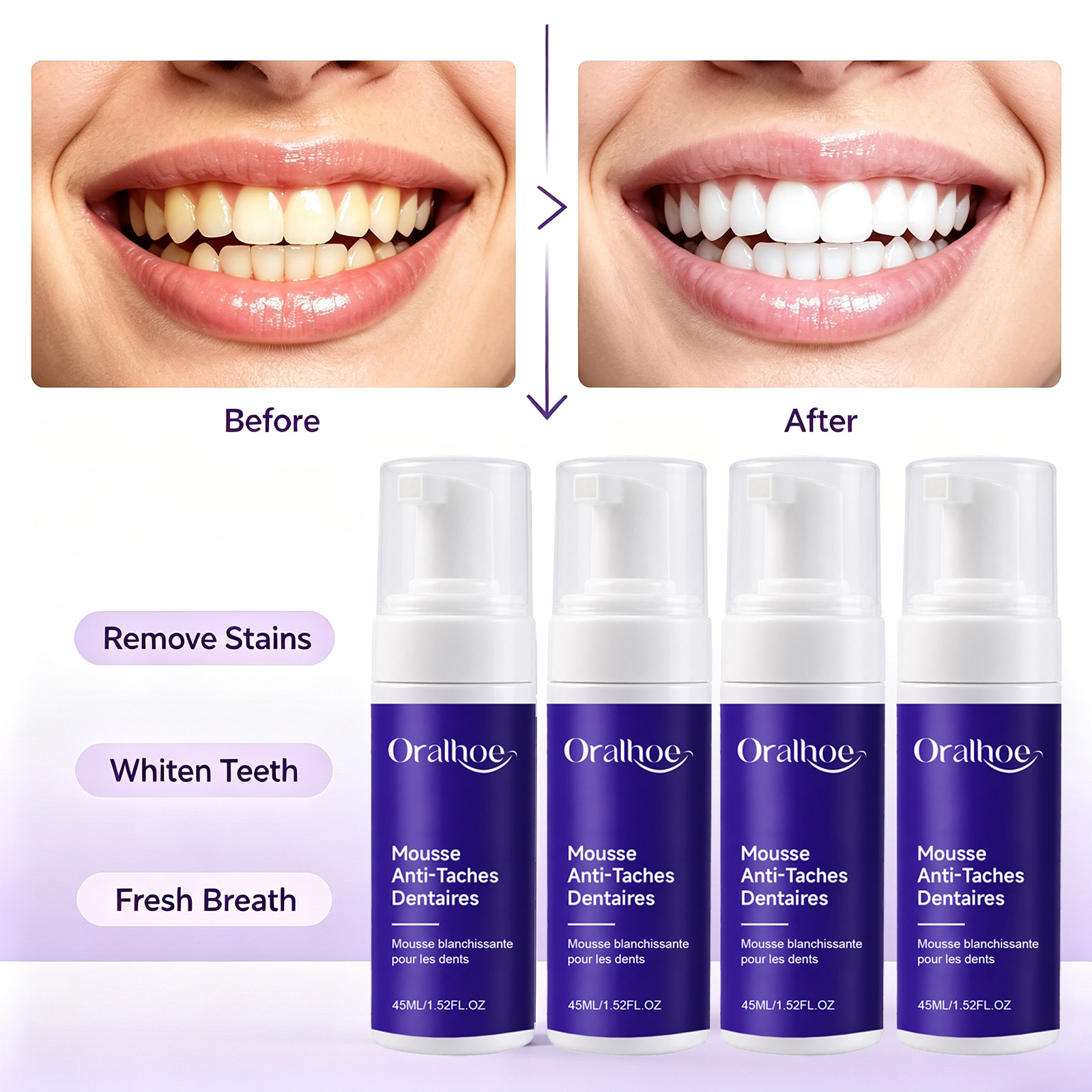 Teeth Whitening Routine - Purple Foaming Teeth Whitening Toothpaste Enamel-Safe