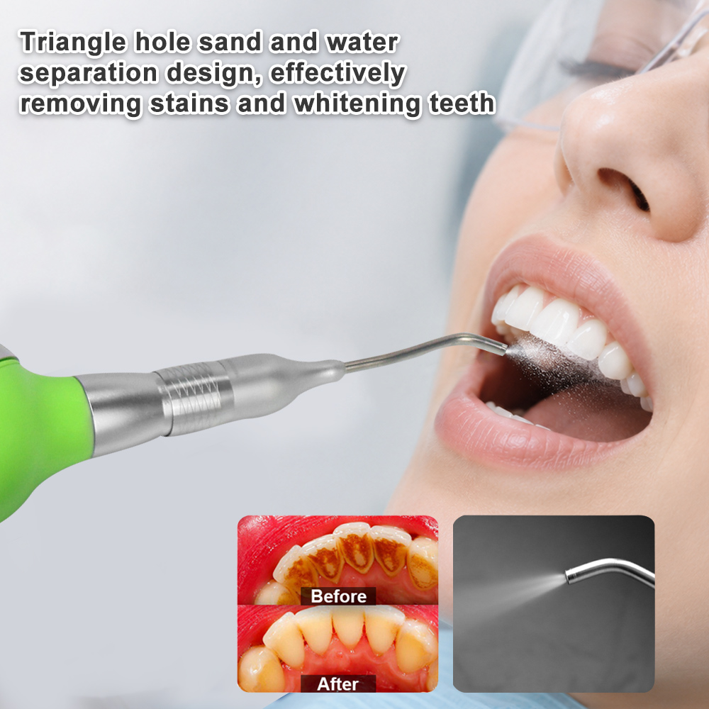 Dental Air Polisher With Anti- - Teeth Whitening Options ulasan dan harga