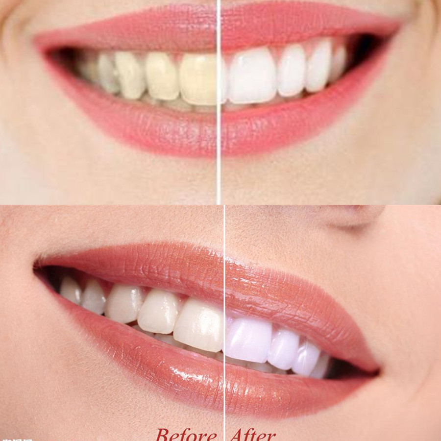 Bamboo Charcoal Teeth Tooth De - Teeth Whitening Co ulasan dan harga