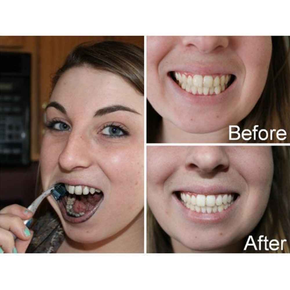 Bamboo Charcoal Teeth Tooth De - Teeth Whitening Co ulasan dan harga