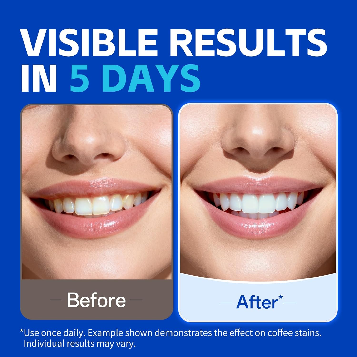 7 pairs Teeth Whitening Strips - Teeth Whitening Strips Permanent ulasan dan harga