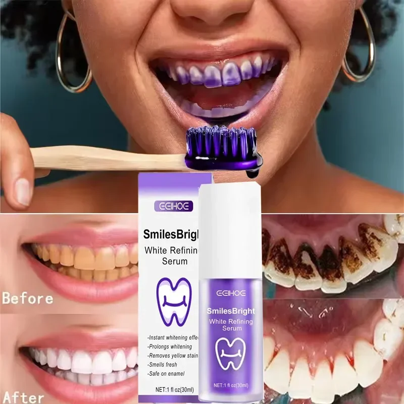 Teeth Cleansing Whitening Toot - Teeth Whitening In Korea ulasan dan harga