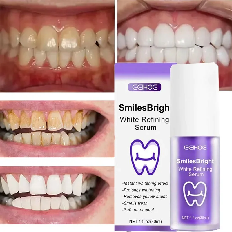 Teeth Cleansing Whitening Toot - Teeth Whitening In Korea ulasan dan harga