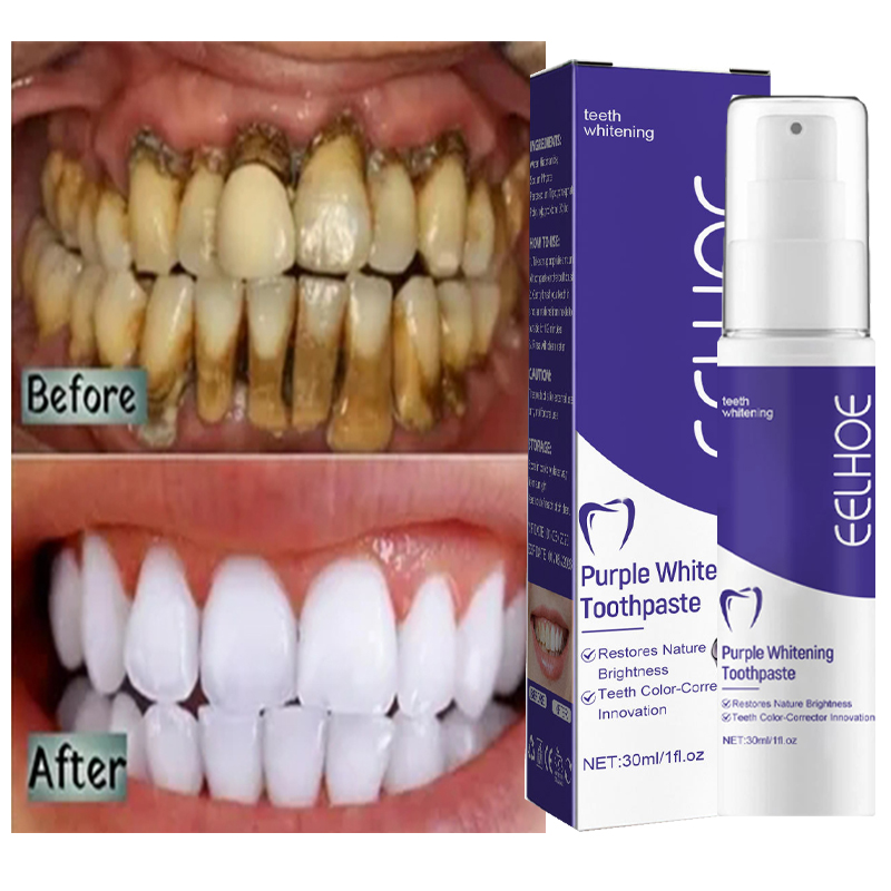 1pcs Teeth Cleansing Whitening - Teeth Whitening In Korea ulasan dan harga