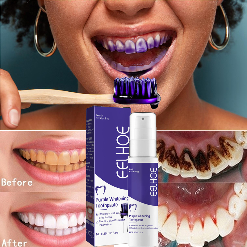 1pcs Teeth Cleansing Whitening - Teeth Whitening In Korea ulasan dan harga