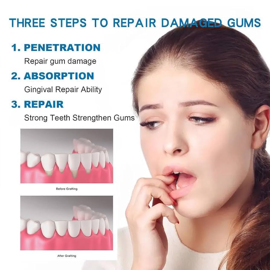 Rapid Repair Gums Gel Effectiv - Teeth Whitening Foam ulasan dan harga