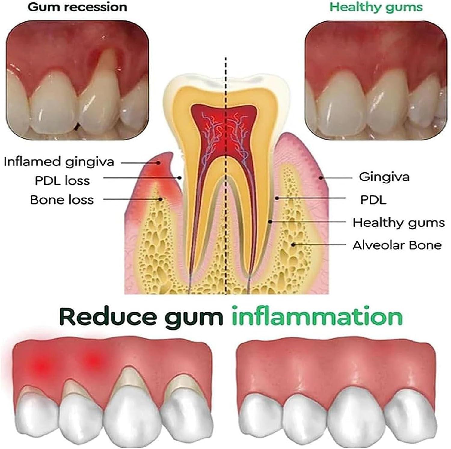 Rapid Repair Gums Gel Effectiv - Teeth Whitening Foam ulasan dan harga