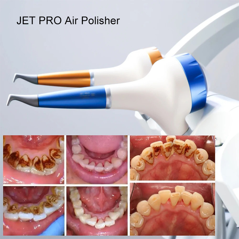 VV Dental  Air Polishing Proph - Teeth Whitening Dental ulasan dan harga