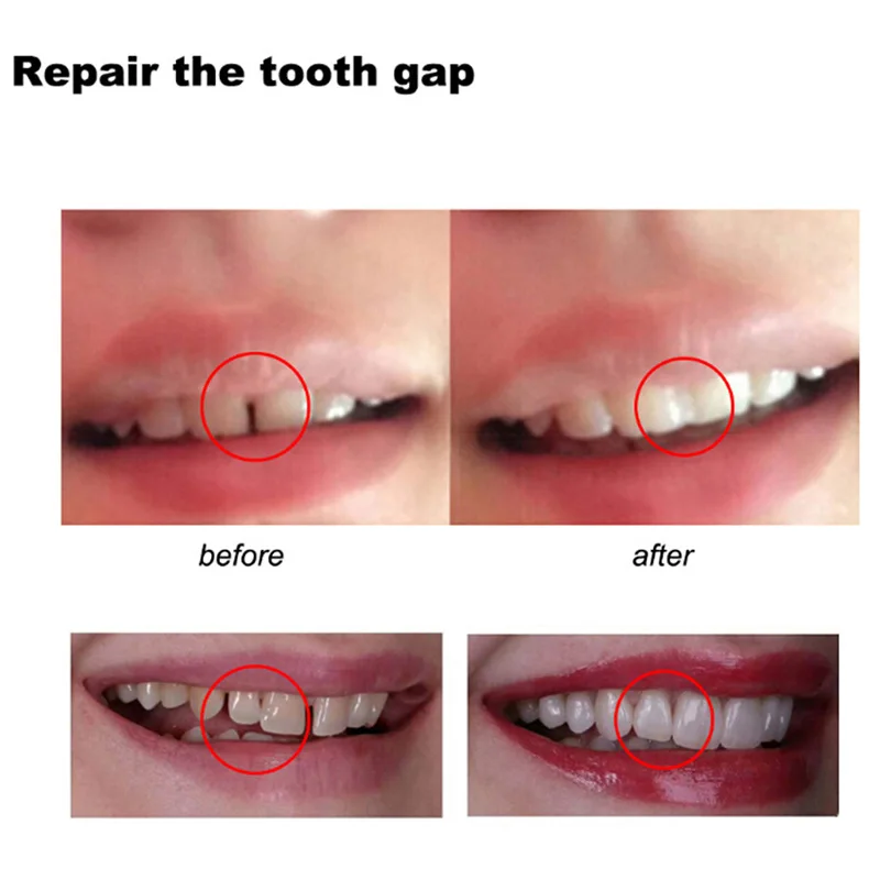 Tooth Repair Glue Shapeable Te - Teeth Whitening At Home ulasan dan harga