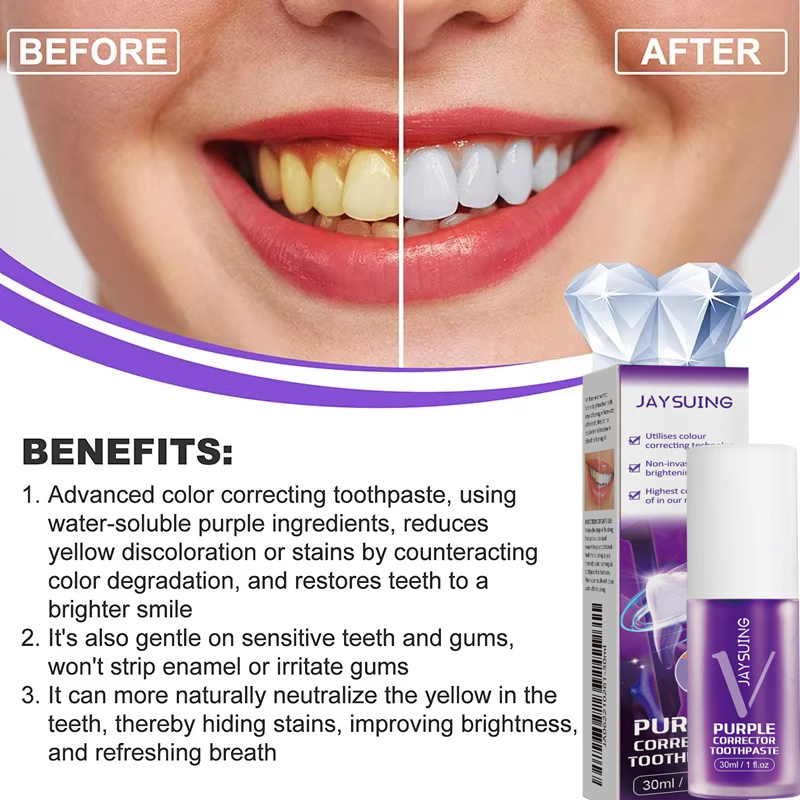 Teeth Cleansing Whitening Toot - Teeth Whitening In Korea ulasan dan harga