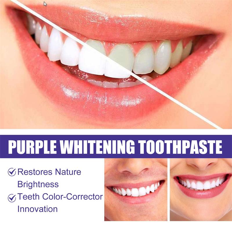 Teeth Cleansing Whitening Toot - Teeth Whitening In Korea ulasan dan harga