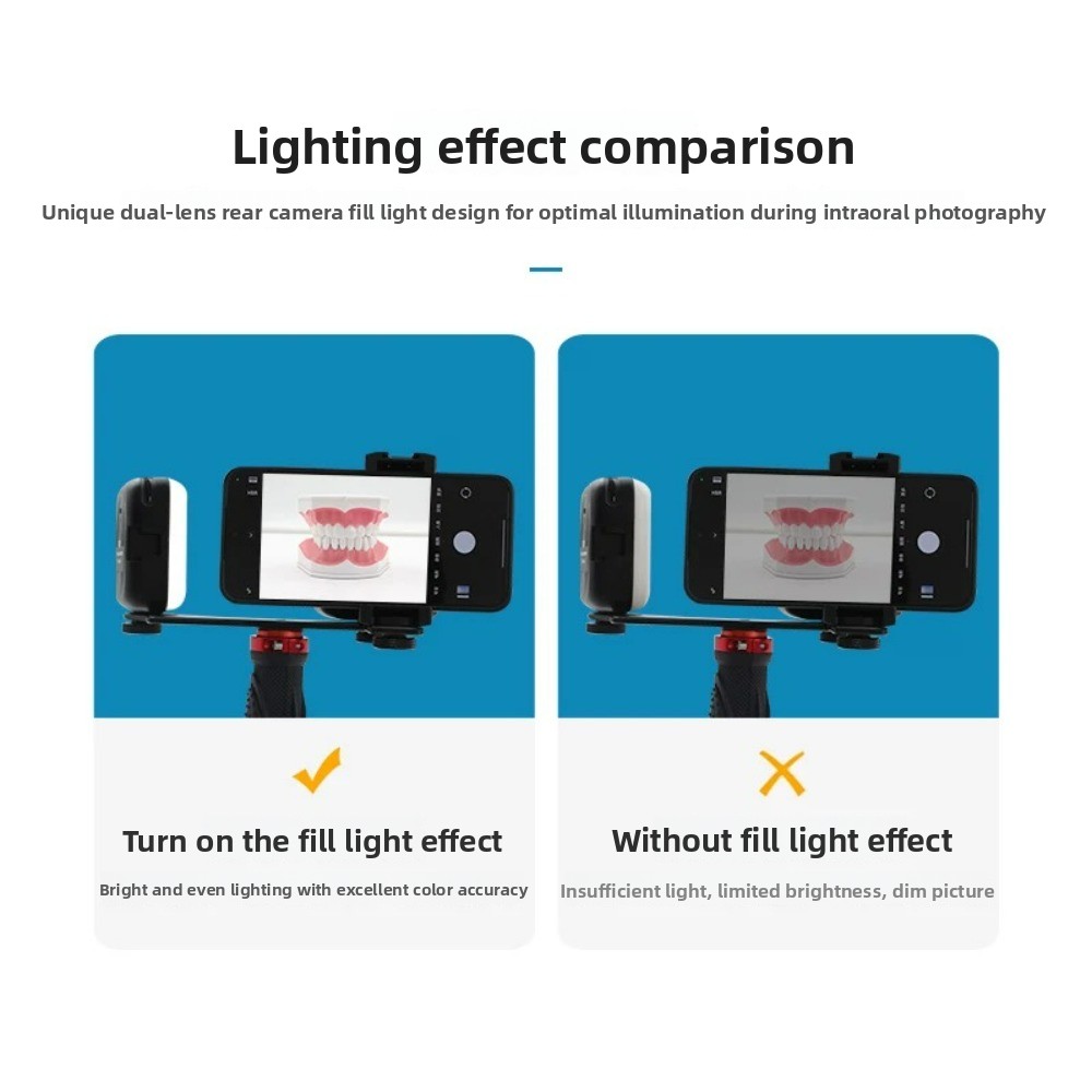 Dental Photography Light, Blue - Teeth Whitening Kit With Light ulasan dan harga
