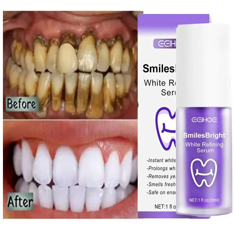 Whitening Toothpaste Teeth Cle - Teeth Whitening In Korea ulasan dan harga