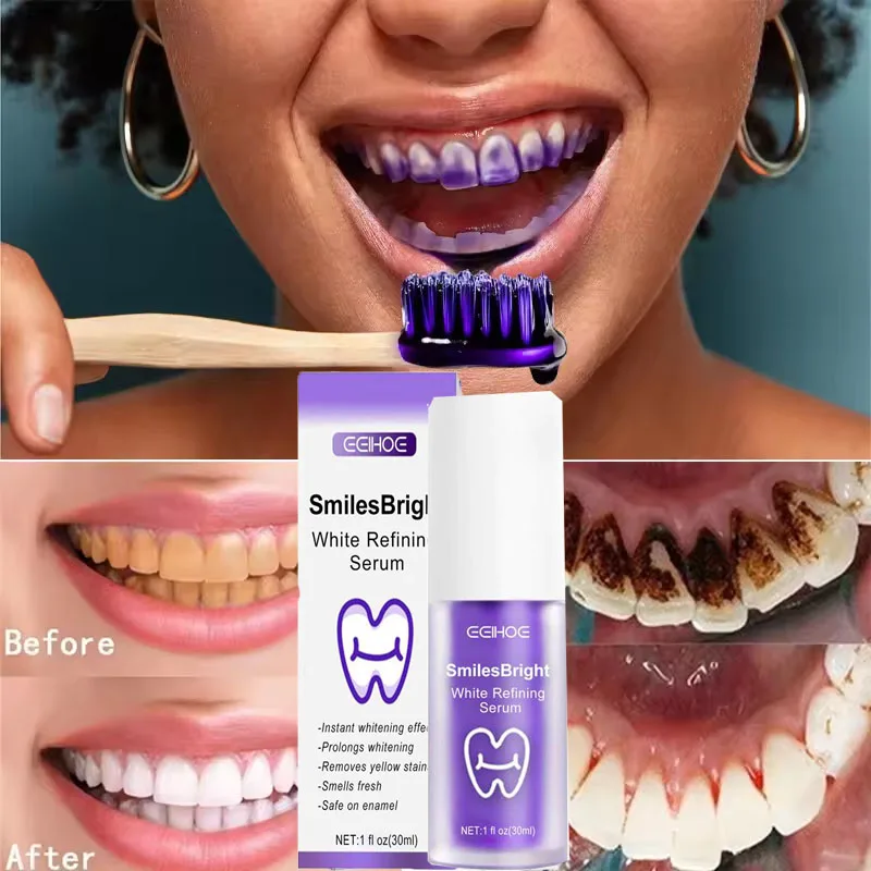 Whitening Toothpaste Teeth Cle - Teeth Whitening In Korea ulasan dan harga
