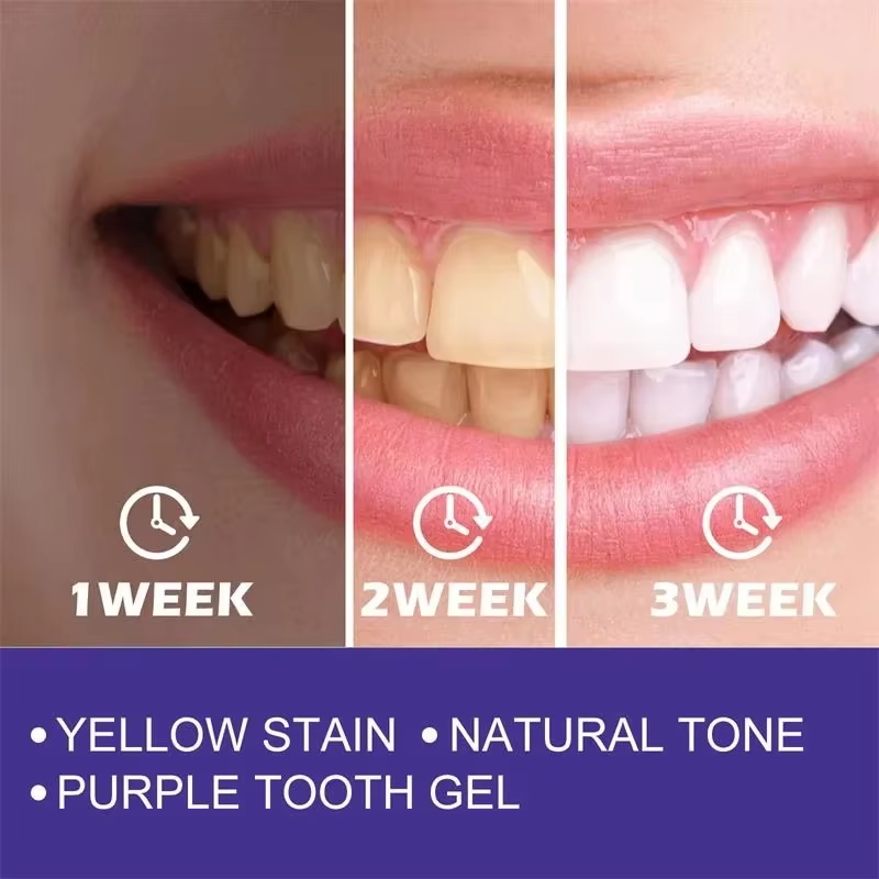Teeth Cleansing Whitening Toot - Teeth Whitening In Korea ulasan dan harga